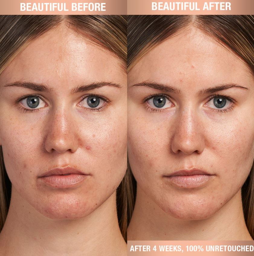 Charlotte Tilbury Charlotte’s Magic Serum with Vitamin C - Imagen 2