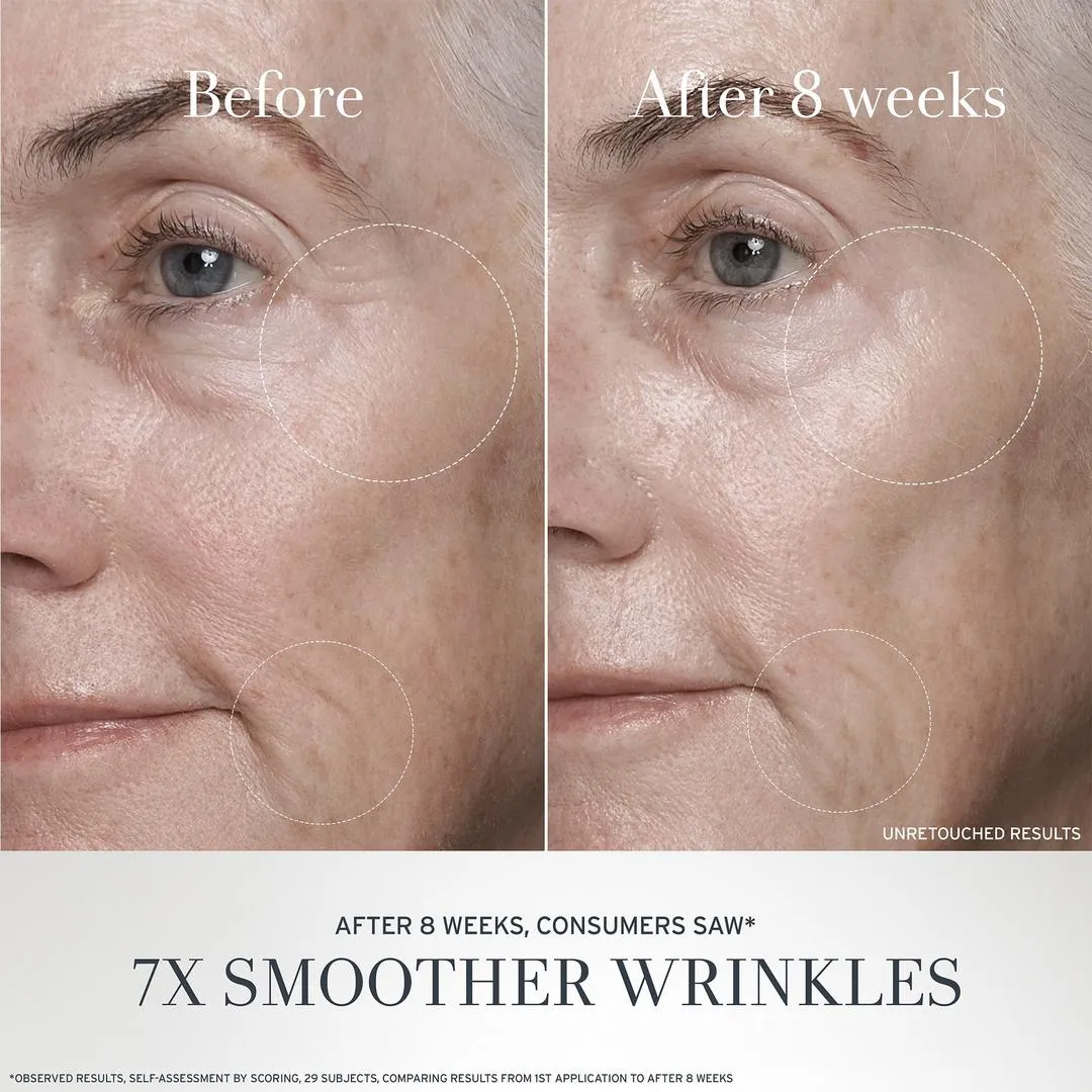 Peter Thomas Roth Potent-C Vitamin C Power Serum - Imagen 5