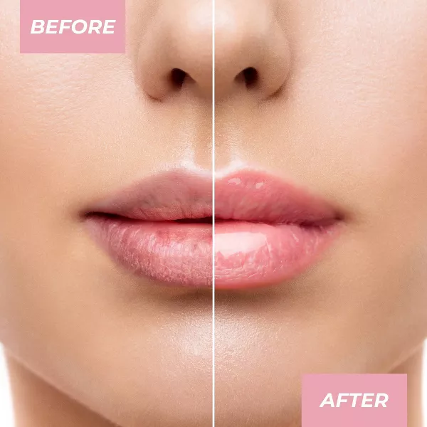 MCoBeauty Overnight Lip Mask - Imagen 4