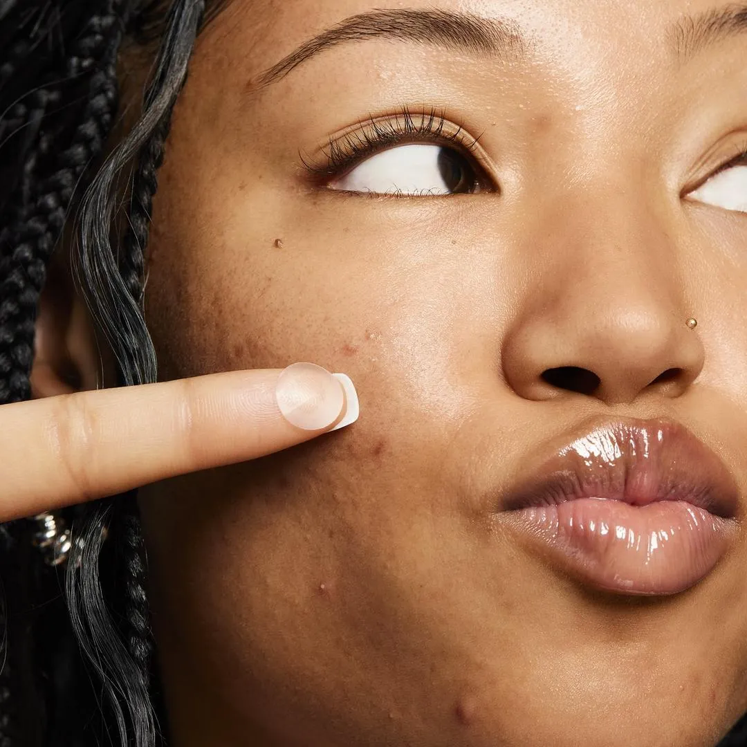 e.l.f. Cosmetics Blemish Breakthrough Stick It to Zits Pimple Patches - Imagen 3