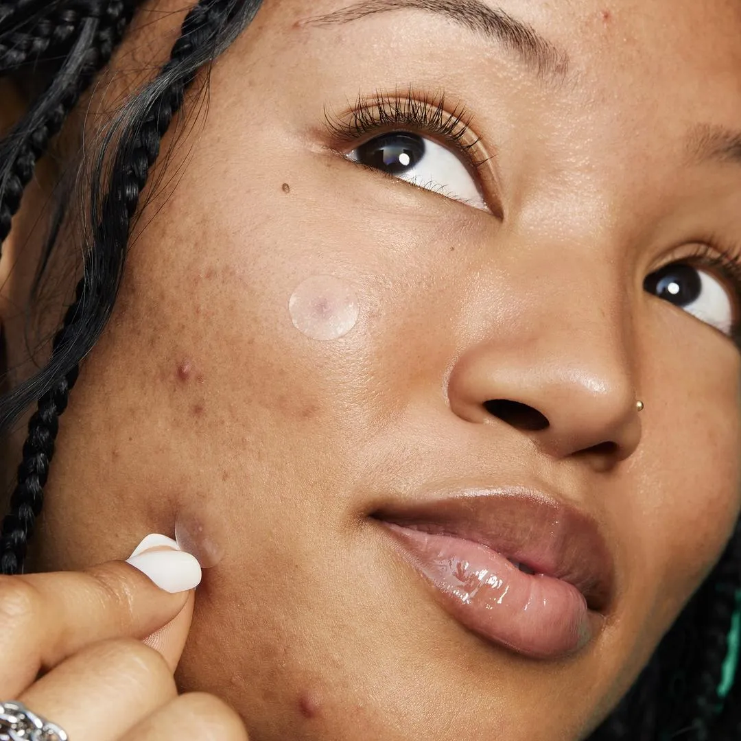 e.l.f. Cosmetics Blemish Breakthrough Stick It to Zits Pimple Patches - Imagen 2