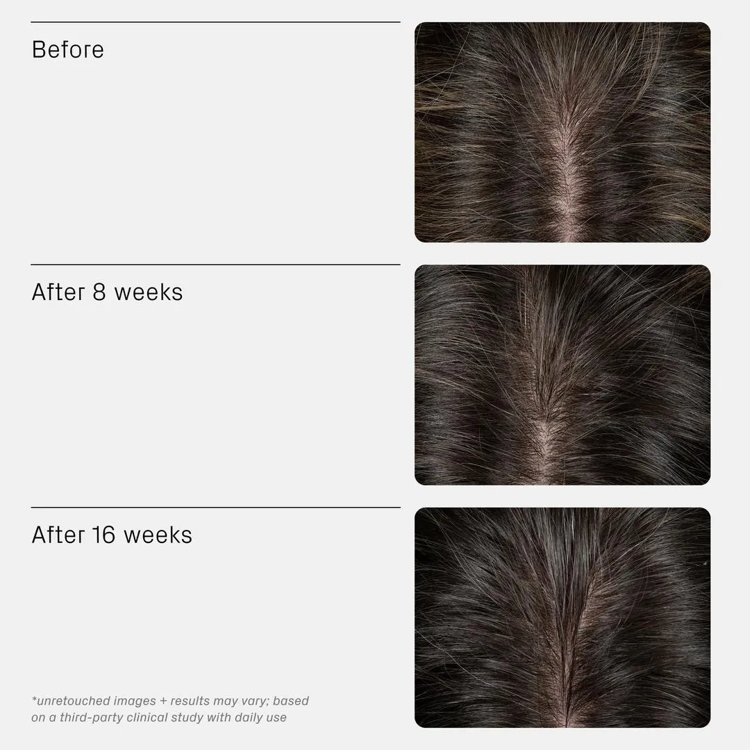 isima Iconic Densifying Scalp Serum - Imagen 2