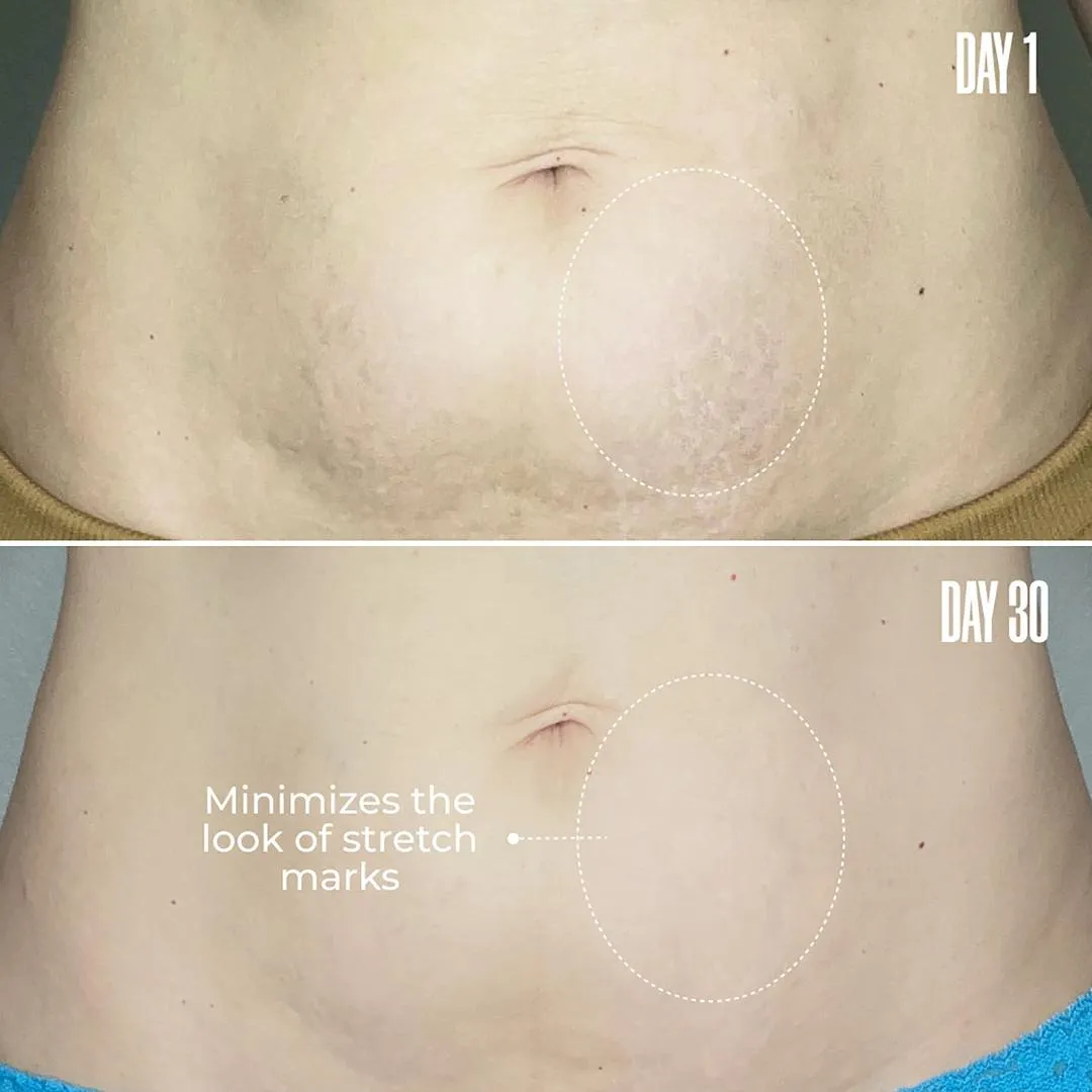 MAËLYS RE-LURE Tight & Tone Body Serum - Imagen 2