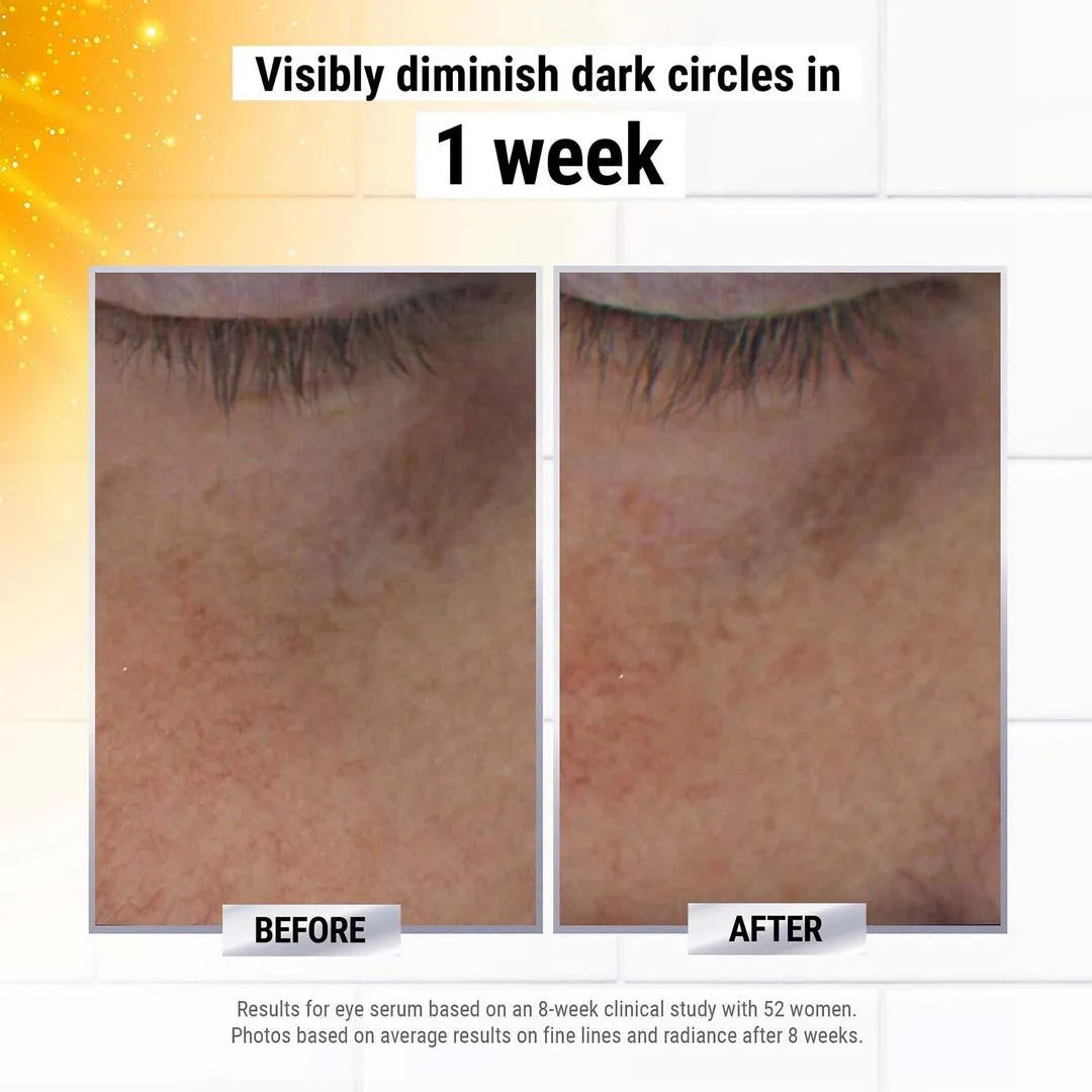 Kiehl's Since 1851 Powerful-Strength Dark Circle Reducing Vitamin C Eye Serum - Imagen 2