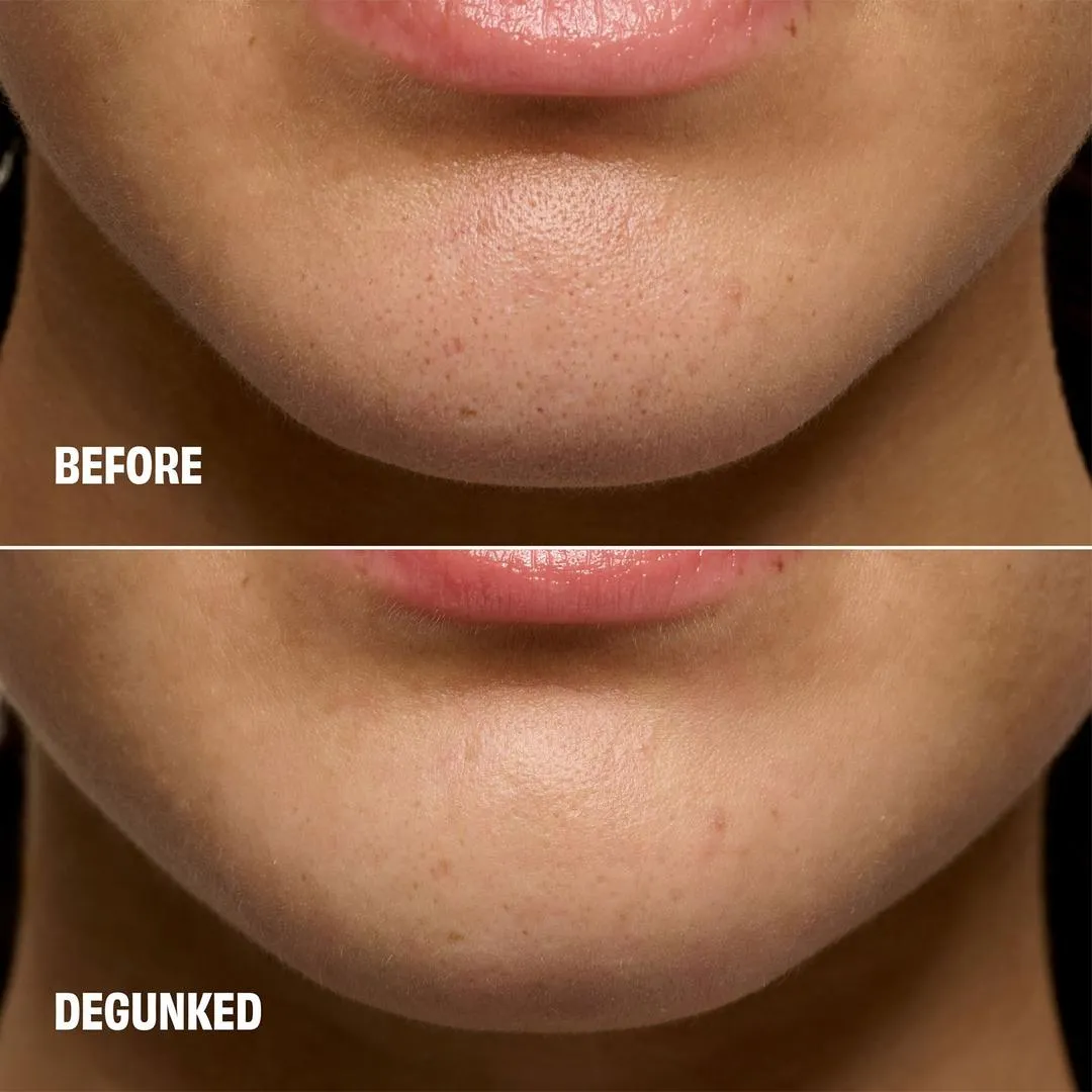 Benefit Cosmetics The POREfessional Degunker Blackhead & Pore Cleansing Mask System - Imagen 4