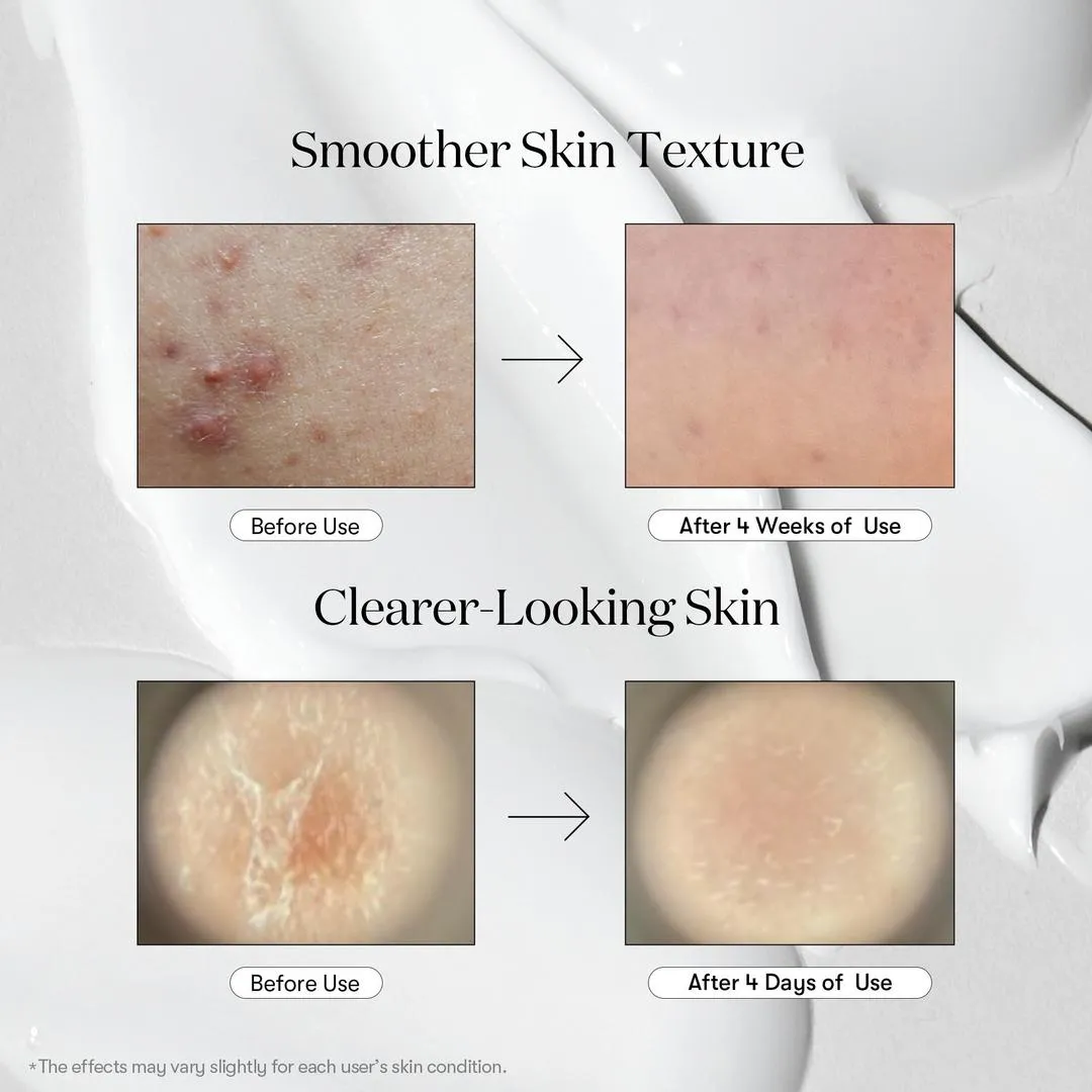 VT Cosmetics Reedle Shot 700 - Imagen 3